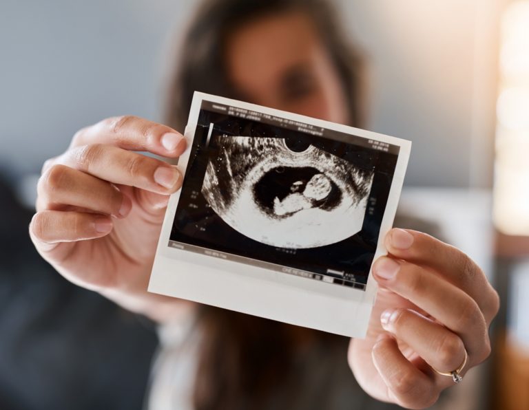 Photo d'une femme tenant une échographie de son bébé à naître